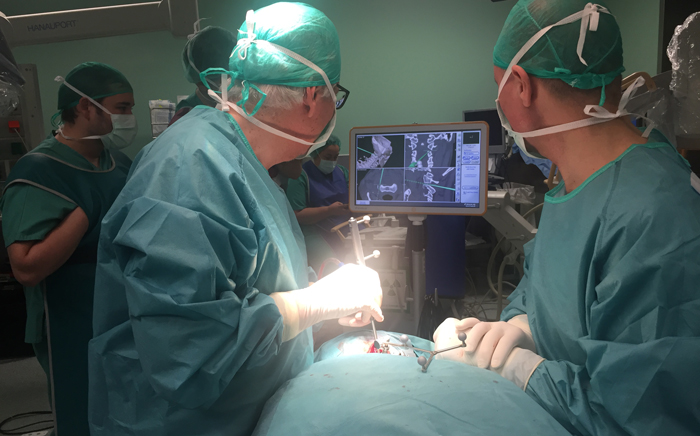 El Dr. Bartolomé Oliver y Vicenç Gilete utilizan por primera vez en España el sistema Bendini en los huesos cervicales
