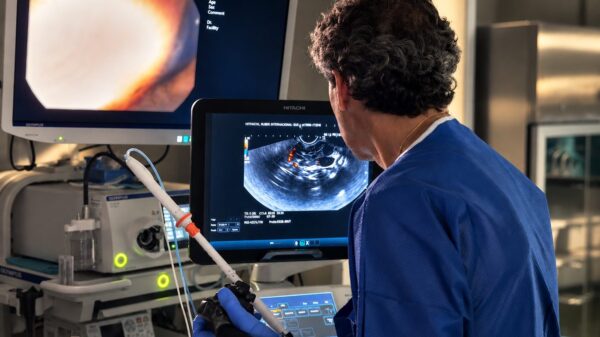 Una técnica mínimamente invasiva permite destruir un tumor de páncreas sin necesidad de cirugía